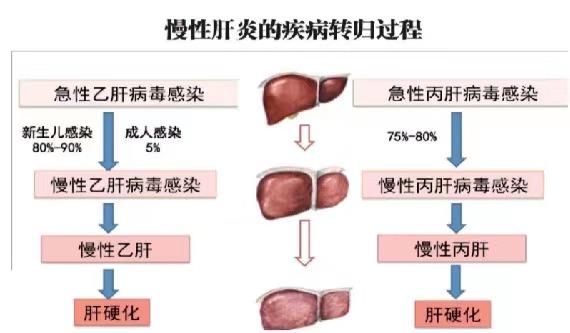 【健康科普】世界肝炎日——堅(jiān)持早預(yù)防，加強(qiáng)檢測發(fā)現(xiàn)，規(guī)范抗病毒治療